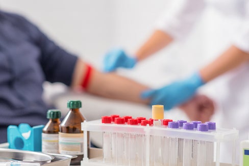 Neuerungen bei Absagen von Laborterminen ab November (Foto: 123rf)