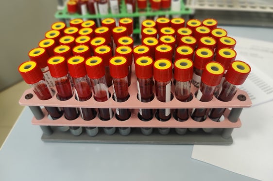 Hepatits-C-Vorsorge - Blutproben