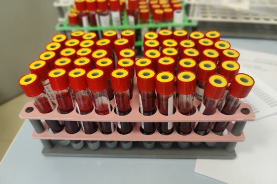 Hepatits-C-Vorsorge - Blutproben
