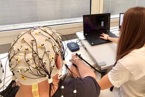 Studie Brain-Computer-Interface: Patienten gesucht