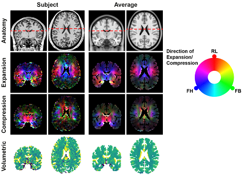 MRI images of the brain