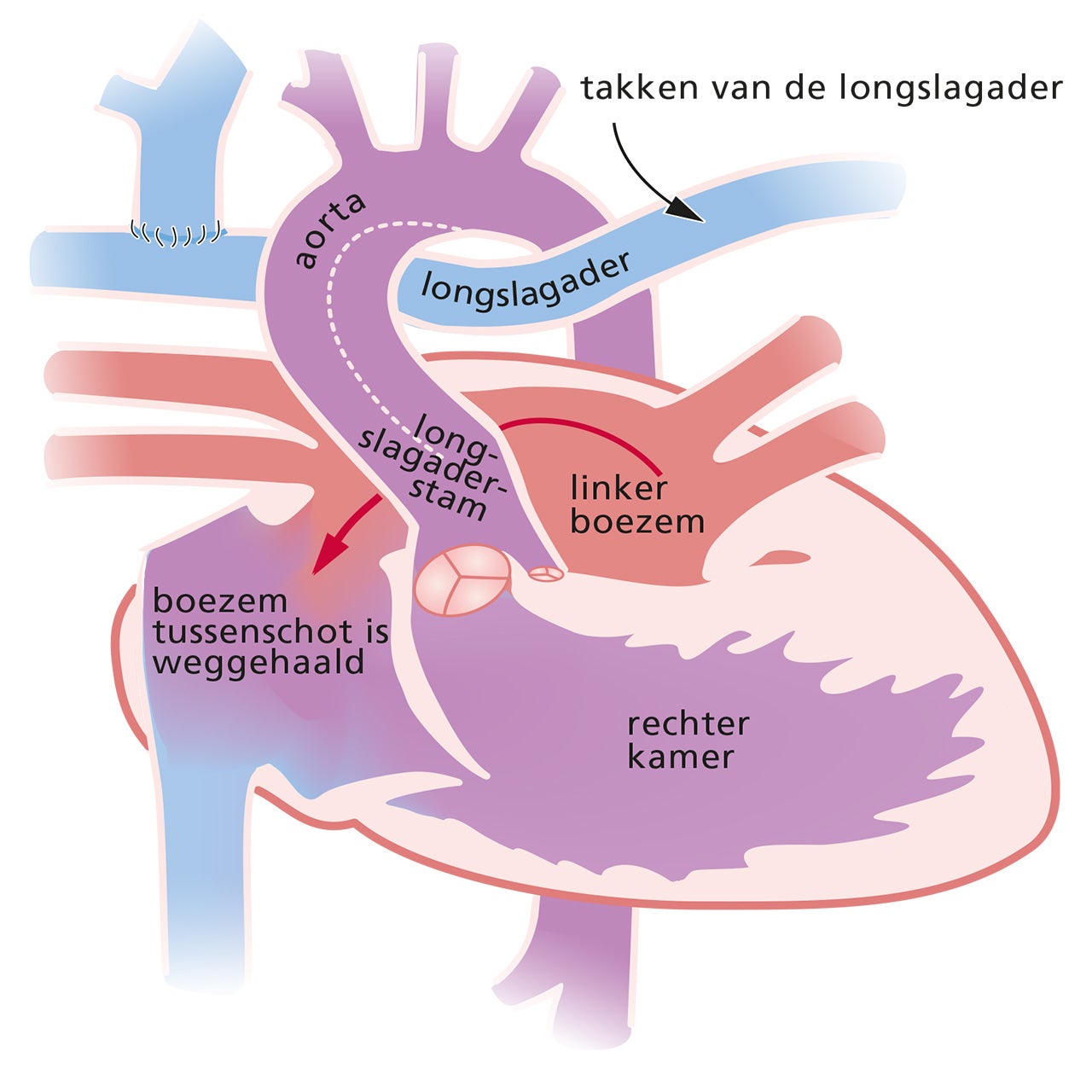 Generieke content afbeelding