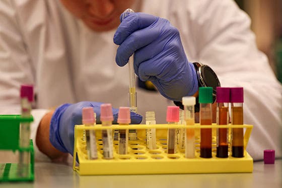 Laboratoriummedewerker in witte jas voert experimenten uit met reageerbuizen en bloedmonsters