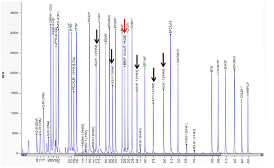 Voorbeeld van een electropherogram van MS-MLPA voor MLH1 van een patiënt met MLH-1 methylatie en een BRAF V600E mutatie. De rode pijl toont de piek van de probe voor de BRAF V600E mutatie, de zwarte pijlen tonen de pieken van de MLH-1 probes. 