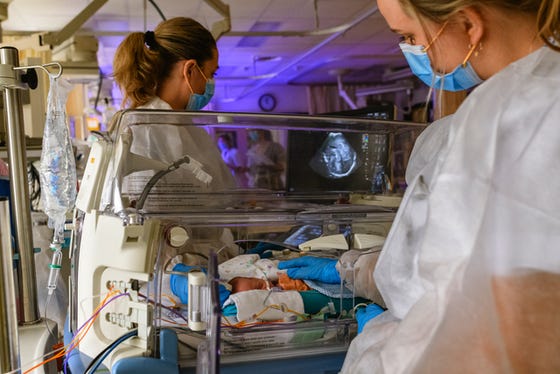 Te vroeg geboren baby wordt onderzocht door twee zorgverleners