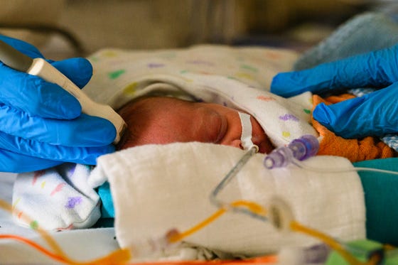 Baby ligt tussen hydrofiele doeken met ogen dicht, zorgverlener houdt echoapparaatje op het hoofd van de baby, maakt echo van de hersenen van de baby.