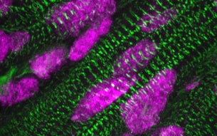 Aanwezigheid van ARID1A (roze) in de celkernen van hartspiercellen (groen), een aantal dagen na de geboorte