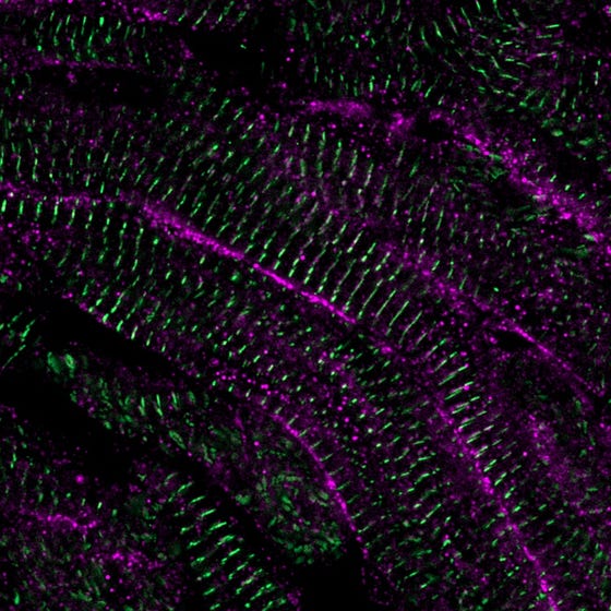 Structured and mature heart muscle cells in the zebrafish heart 60 days after damage