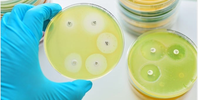 Agar plate