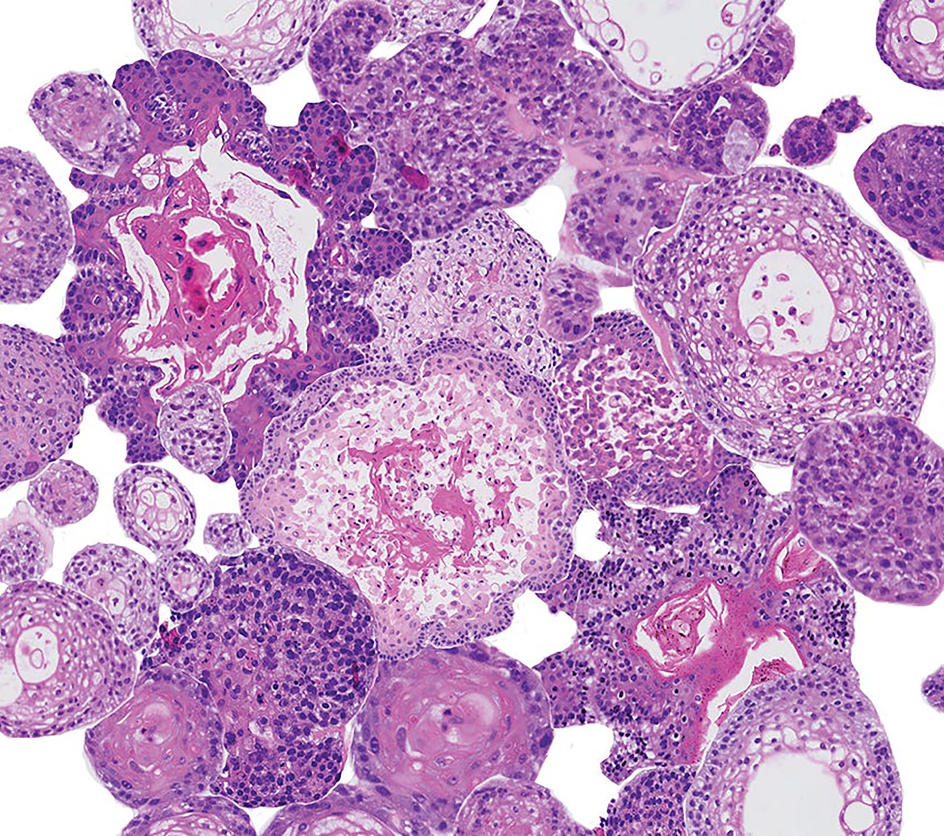 Een close-up van een microscoop; organoiden hoofd-halskanker