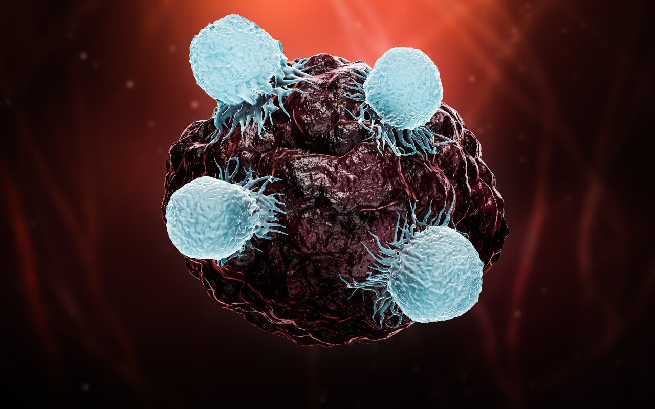 3D image of a tumor being attacked by white blood cells.