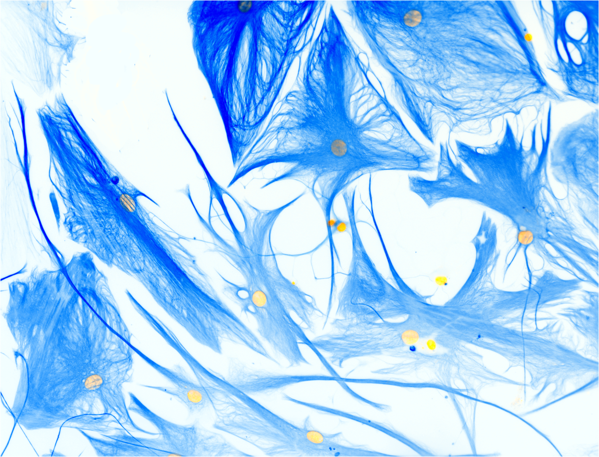 GliaNed