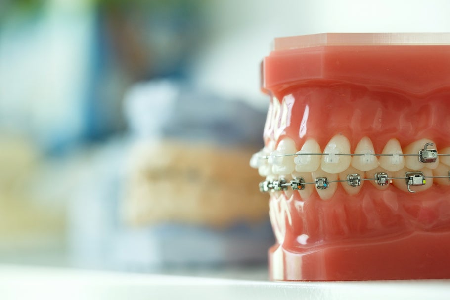 Buying an orthodontic practice? 