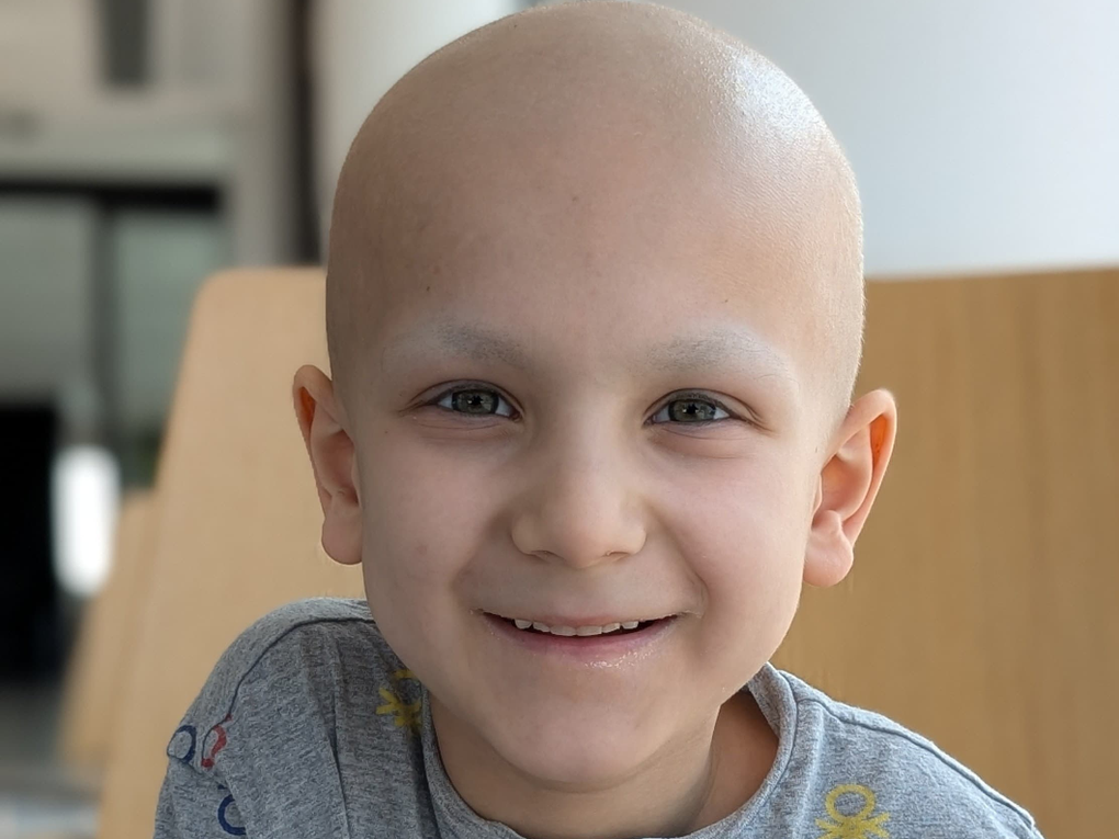 Ein krebskrankes Kind mit Glatze lächelt in die Kamera. Ein krebskrankes Kind mit Glatze lächelt in die Kamera.