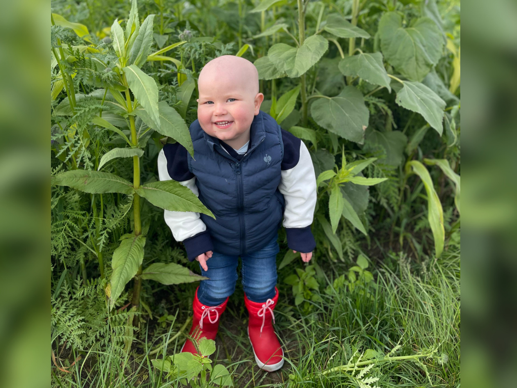 Ein Kleinkind mit Glatze steht vor einem Sonnenblumenfeld. Ein Kleinkind mit Glatze steht vor einem Sonnenblumenfeld.