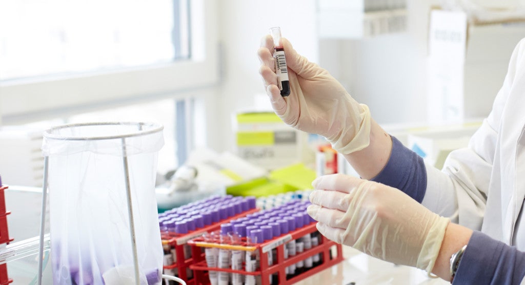 Täglich werden Tausende von Proben im DKMS Life Science Lab ausgewertet. Täglich werden Tausende von Proben im DKMS Life Science Lab ausgewertet.