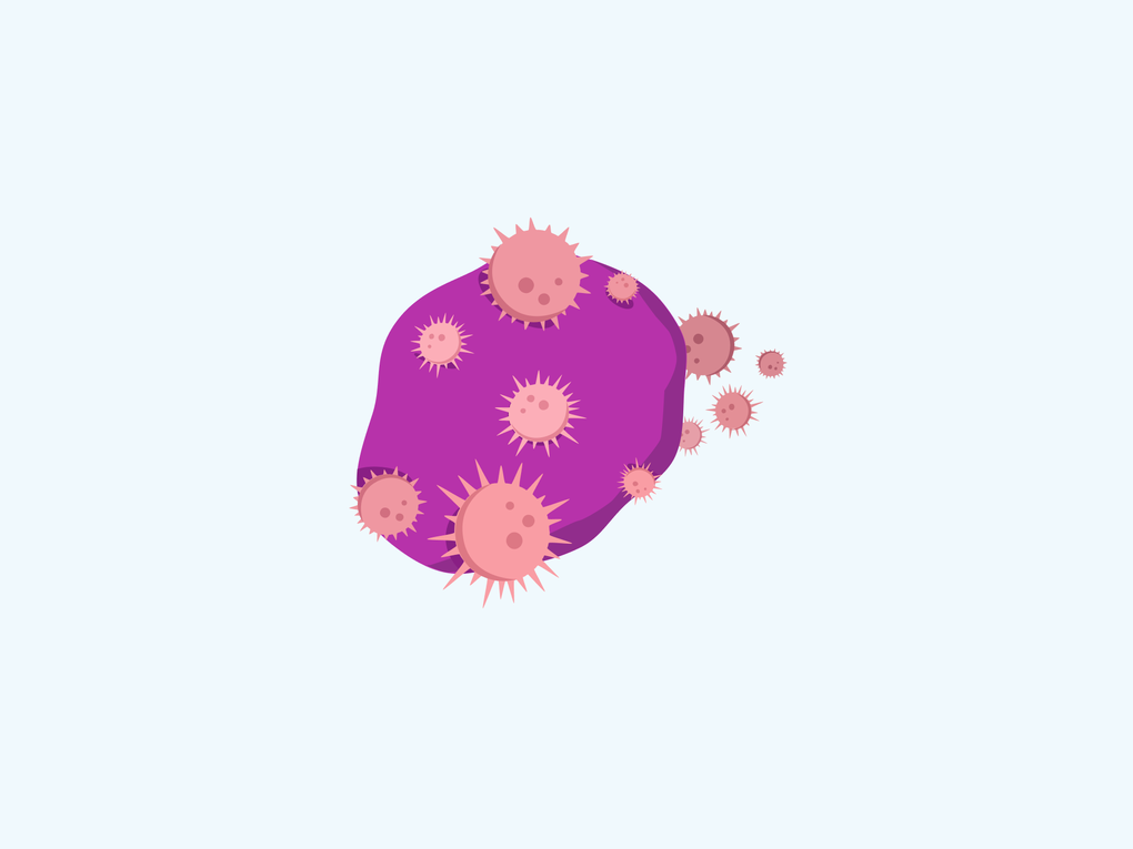 Illustration einer Lymphomzelle mit umliegenden Immunzellen. Illustration einer Lymphomzelle mit umliegenden Immunzellen.