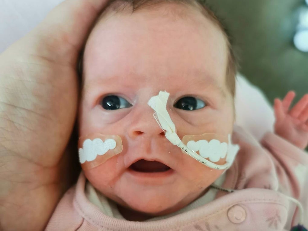 Foto von einem kleinen Kind mit Schläuchen in der Nase Foto von einem kleinen Kind mit Schläuchen in der Nase