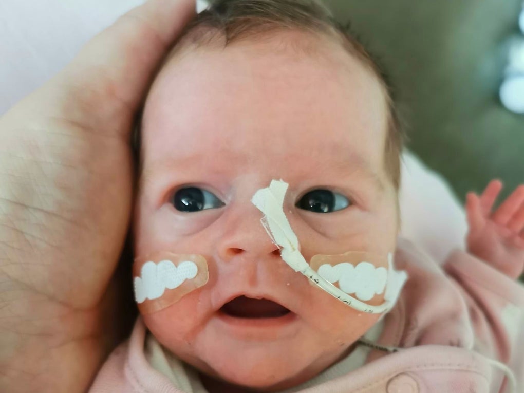 Foto von einem kleinen Kind mit Schläuchen in der Nase Foto von einem kleinen Kind mit Schläuchen in der Nase