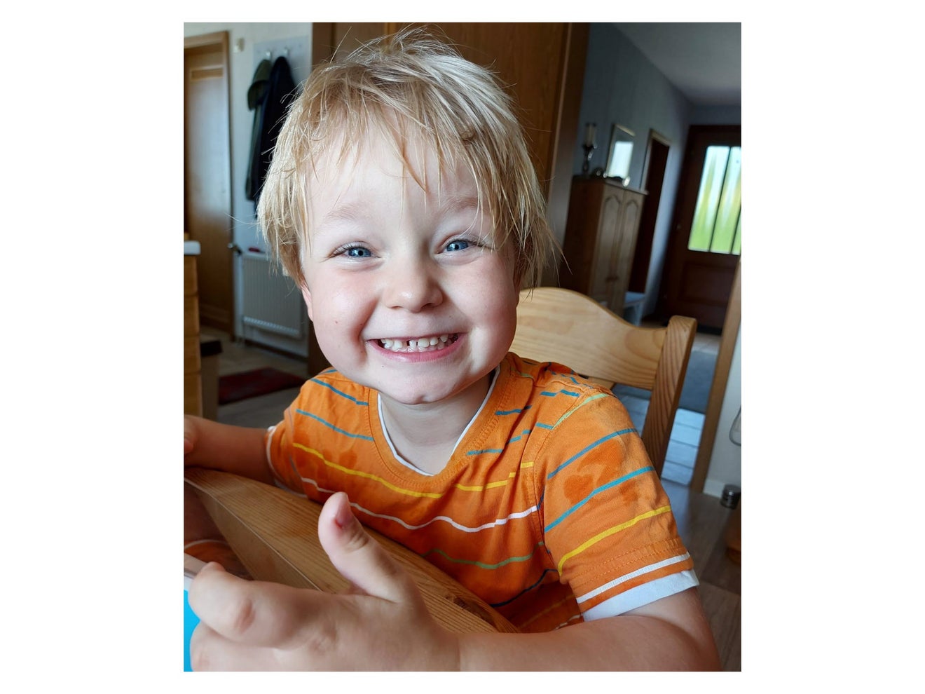 Patient Samu (4) lacht in die Kamera. Patient Samu (4) lacht in die Kamera.