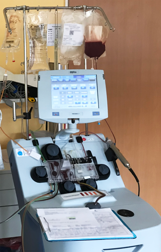 Ein Aspherese Gerät in einem Raum Ein Aspherese Gerät in einem Raum