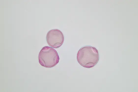 Birkenpollen unter dem Mikroskop (Foto: Landesagentur für Umwelt und Klimaschutz)