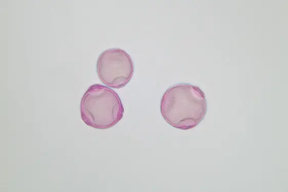 Birkenpollen unter dem Mikroskop (Foto: Landesagentur für Umwelt und Klimaschutz)