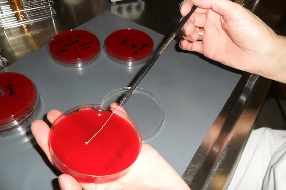Mikrobiologische Untersuchung: Bakterienausstrich auf Nährboden (Foto: Landesagentur für Umwelt und Klimaschutz)
