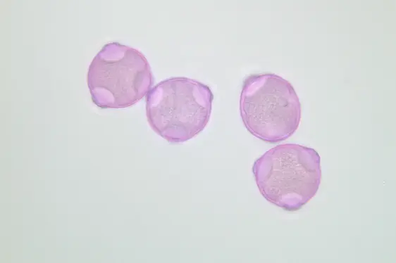 Lichtmikroskopische Aufnahme von mit Fuchsin gefärbten Pollen der Hopfenbuche (Foto: Landesagentur für Umwelt und Klimaschutz)