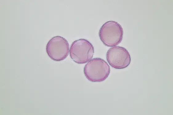 Lichtmikroskopische Aufnahme von mit Fuchsin gefärbten Pollen der Manna-Esche (Foto: Landesagentur für Umwelt und Klimaschutz)