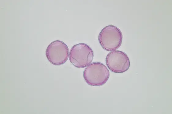 Lichtmikroskopische Aufnahme von mit Fuchsin gefärbten Pollen der Manna-Esche (Foto: Landesagentur für Umwelt und Klimaschutz)