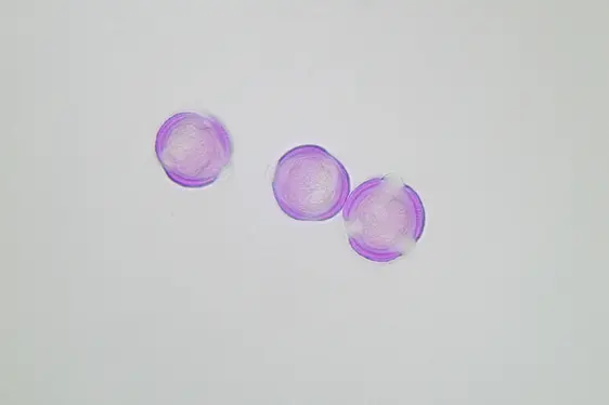 Lichtmikroskopische Aufnahme von mit Fuchsin gefärbten Beifuß-Pollen (Foto: Landesagentur für Umwelt und Klimaschutz)