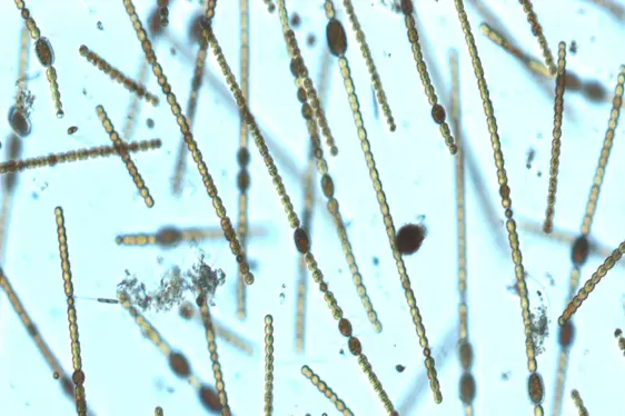 Lichtmikroskopische Aufnahme von Kolonien von Dolichospermum viguieri (Foto: Landesagentur für Umwelt und Klimaschutz)