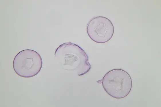 Lichtmikroskopische Aufnahme von mit Fuchsin gefärbten Pollen der Zypresse (Foto: Landesagentur für Umwelt und Klimaschutz)