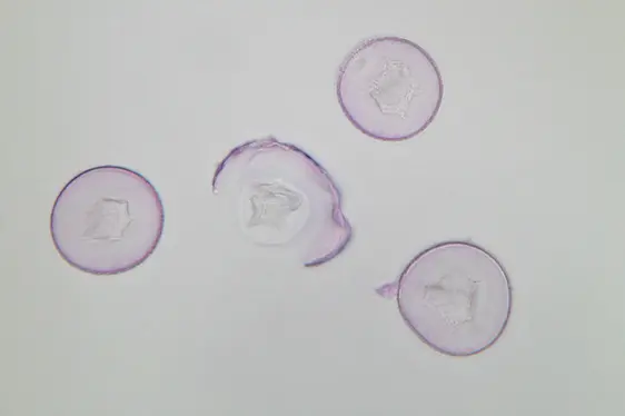 Lichtmikroskopische Aufnahme von mit Fuchsin gefärbten Pollen der Zypresse (Foto: Landesagentur für Umwelt und Klimaschutz)