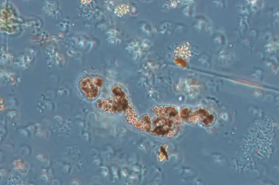 Lichtmikroskopische Aufnahme von einer Kolonie von Microcystis wesembergii (Foto: Landesagentur für Umwelt und Klimaschutz)