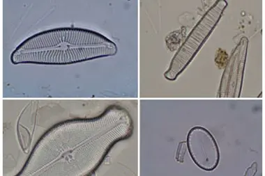 Kieselalgen - Kieselalgen unter dem Durchlichtmikroskop (Foto: Landesagentur für Umwelt und Klimaschutz)