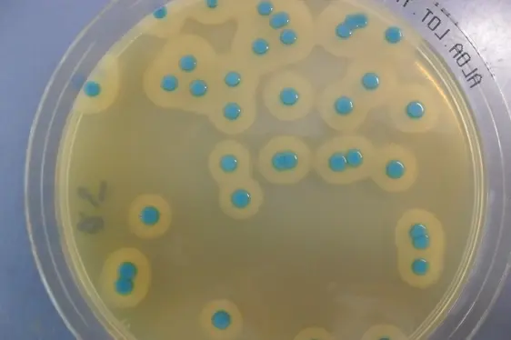 Petrischale mit Listeria monocytogenes-Kolonien (Foto: Landesagentur für Umwelt und Klimaschutz)