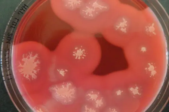 Petrischale mit Bacillus cereus-Kolonien (Foto: Landesagentur für Umwelt und Klimaschutz)