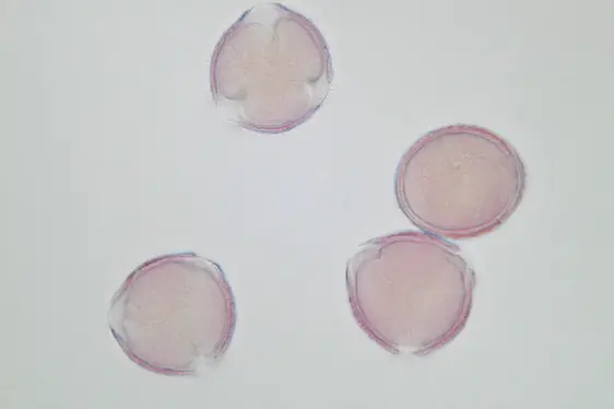 Lichtmikroskopische Aufnahme von mit Fuchsin gefärbten Pollen der Flaum-Eiche; Pollen im optischen Schnitt (Foto: Landesagentur für Umwelt und Klimaschutz)