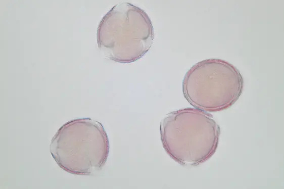 Lichtmikroskopische Aufnahme von mit Fuchsin gefärbten Pollen der Flaum-Eiche; Pollen im optischen Schnitt (Foto: Landesagentur für Umwelt und Klimaschutz)