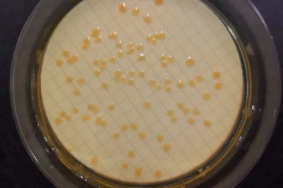 Mikrobiologische Untersuchung: Coliforme Keime im Wasser; Petrischale mit Kolonien von Coliforme-Keimen (Foto: Landesagentur für Umwelt und Klimaschutz)