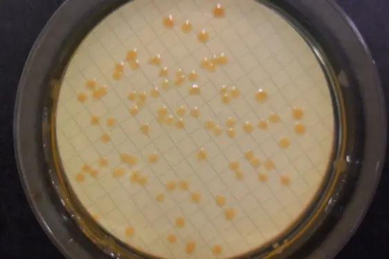 Mikrobiologische Untersuchung: Coliforme Keime im Wasser; Petrischale mit Kolonien von Coliforme-Keimen (Foto: Landesagentur für Umwelt und Klimaschutz)