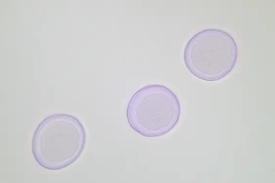 Lichtmikroskopische Aufnahme von mit Fuchsin gefärbten Pollen der Pappel (Foto: Landesagentur für Umwelt und Klimaschutz, Kofler)