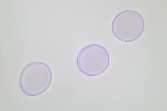 Lichtmikroskopische Aufnahme von mit Fuchsin gefärbten Pollen der Pappel (Foto: Landesagentur für Umwelt und Klimaschutz, Kofler)