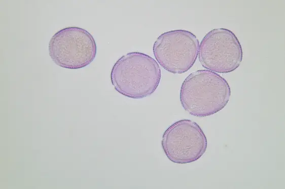 Lichtmikroskopische Aufnahme von mit Fuchsin gefärbten Pollen der Gemeinen Esche, Oberfläche mit genetztem Muster (Foto: Landesagentur für Umwelt und Klimaschutz)