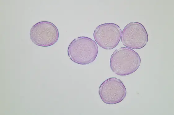 Lichtmikroskopische Aufnahme von mit Fuchsin gefärbten Pollen der Gemeinen Esche, Oberfläche mit genetztem Muster (Foto: Landesagentur für Umwelt und Klimaschutz)