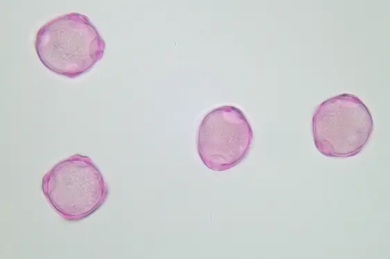Lichtmikroskopische Aufnahme von mit Fuchsin gefärbten Pollen der Erle (Foto: Landesagentur für Umwelt und Klimaschutz)
