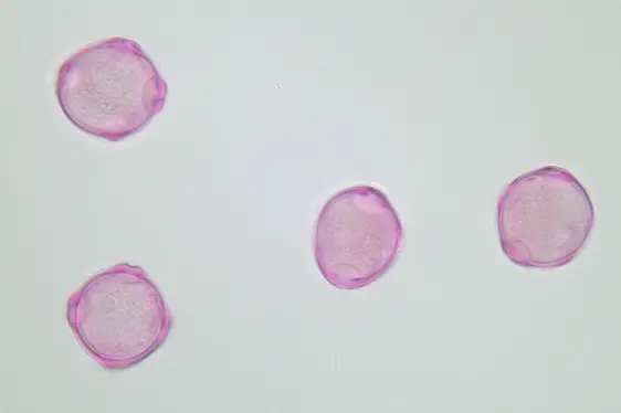 Lichtmikroskopische Aufnahme von mit Fuchsin gefärbten Pollen der Erle (Foto: Landesagentur für Umwelt und Klimaschutz)