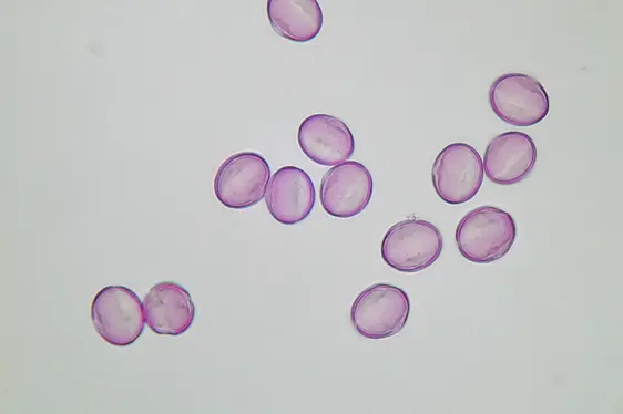 Lichtmikroskopische Aufnahme von mit Fuchsin gefärbten Pollen der Edelkastanie (Foto: Landesagentur für Umwelt und Klimaschutz)